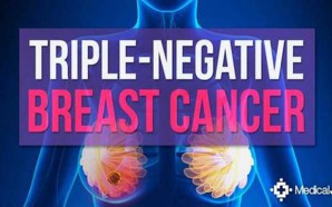 Triple Negative Breast Cancer: Things to Know
