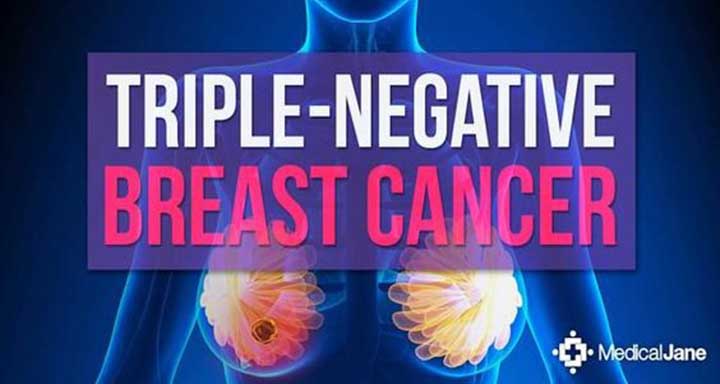 triple negative breast cancer, breast cancer, breast cancer symptoms, breast cancer treatment