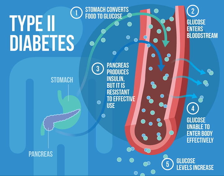 type 2 diabetes, diabetes causes, diabetes symptoms