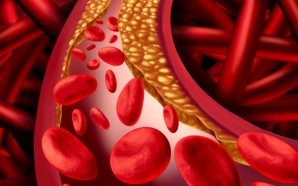 dabigatran, afib, blood thinners, anticoagulants