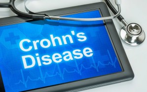 Diagnosing Crohn’s Disease: What’s Involved?