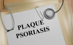 Living with Plaque Psoriasis: Top Tips