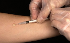 The Shingles Vaccine