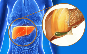 Everything You Should Know About Fatty Liver Disease